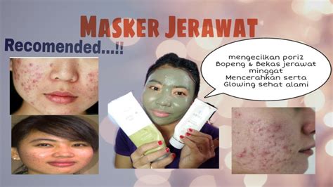 Jun 08, 2021 · baca juga: Cara menghilangkan jerawat, MASKER TERAMPUH PENGHILANG ...