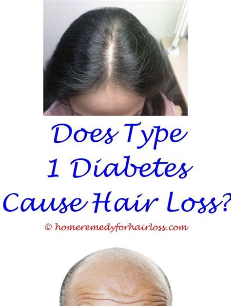 To fully interpret meanings of hair loss in a. hair loss process - garnier nutrisse hair color hair loss ...