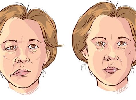 Remdesivir In Myasthaenia Gravis - myasthenia gravis | Just Want to Punch 'em in the Face - It ...