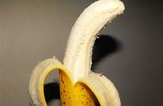 disease penis curved peyronie banana peyronies cancer men risk curvature penises abnormal