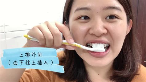 How often should someone visit the dentist for a dentist cleaning treatment? Braces Vlog Day 120 How I brush my teeth with braces 牙套日記第 ...