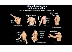 Clinical Evaluation Of The Shoulder Orthopaedicprinciples Com