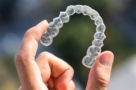 Every one of the aligners moves your teeth slowly towards the desired alignment as per the treatment plan. Do I Need To Wear My Invisalign® Aligners All The Time ...