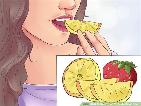 Are white spots different to white marks on the teeth? 3 Ways to Get Rid of White Spots on Teeth - wikiHow