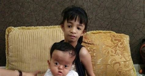 Apakah cuma untuk mereka yang berpenampilan menarik dengan kehidupan yang cukup baik? Yola dan Odilia, Cinta Sempurna untuk Anak Penderita ...