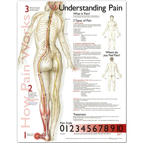 The sort of graph used depends on the kind of information. Understanding Pain Anatomical Chart - The Physio Shop