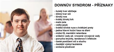 Down syndrome or down's syndrome, also known as trisomy 21, is a genetic disorder caused by the presence of all or part of a third copy of chromosome 21. Downův syndrom - příznaky, projevy, symptomy - Příznaky a ...