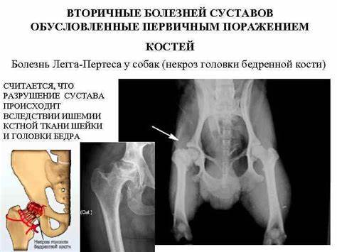 Болезнь суставов диета