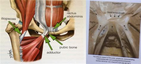 Quadratus femoris posterior hip rotator muscles posterior posterior. Groin pain, treatment and terminology - by Sam Blanchard ...