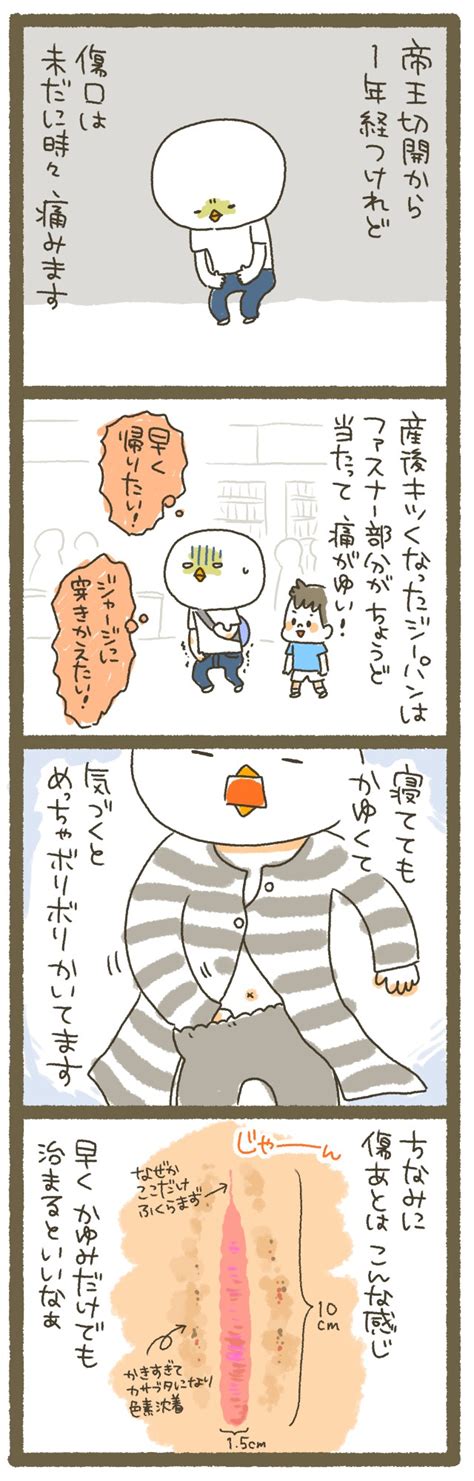 最良かつ最も包括的な 1 年 帝王 切開 傷 - 我がメガと