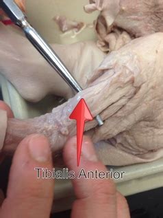 It is part of the lower limb. Shank - Hamlet: Dissected