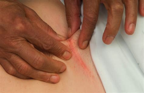Advanced massage for experienced couples. Chiropractic Care Reduces Scar Tissue | Advanced Health ...