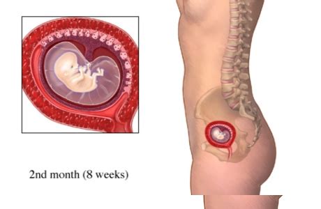 Hoy es 13 de junio y sigo sin regla. Aborto Séptico