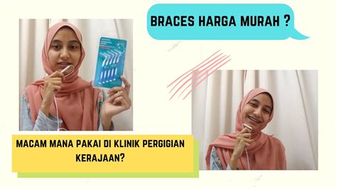 Jadi pergilah yang berdekatan dan yang lebih murah (tgk ekonomi sdr lah guana hehe). Pakai braces di klinik pergigian kerajaan (Updated) - YouTube