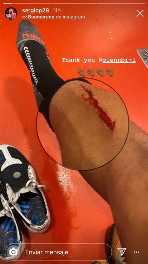 Jun 19, 2021 · sergio pena en los greenes, pero acierta a taponar la hemorragia. Instagram: Sergio Pena revelo los resultados del golpe que ...