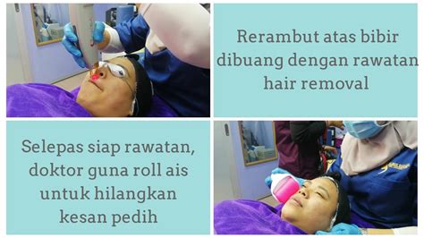 Laser 4d ada di klinik primer nilam puri, kota bharu. KLINIK SUZANA KLINIK PAKAR ESTETIK DAN KULIT DI JOHOR ...