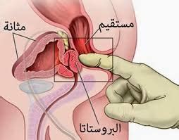 ٠٨:٣٤ ، ٥ يوليو ٢٠٢٠. أعراض تضخم البروستاتا وعلاجها - Plastic Surgery Istanbul