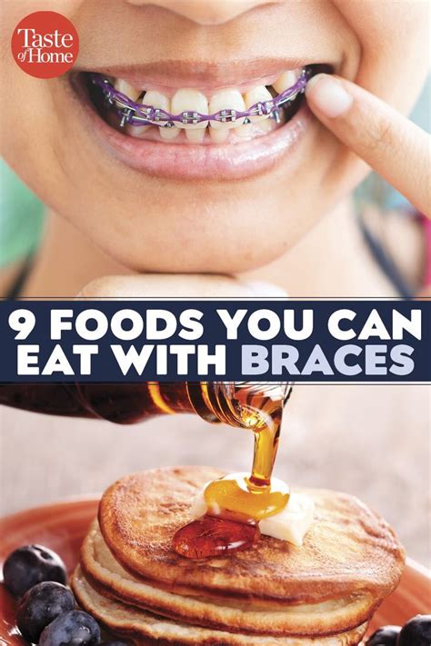 In general, you will want foods that are softer in texture, especially for that period right after having your braces. 9 Foods You Can Eat With Braces | Braces food, Braces ...