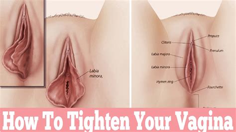 Teeth naturally tighten themselves back up over a short period of time. Vaginal tightening Gel