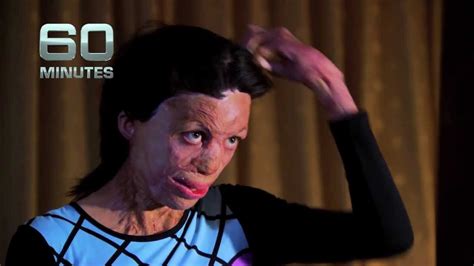 Saudi fugitives, the high cost of healing, excited delirium 43:22 dec 13, 2020. TURIA PITT | 60 MINUTES - YouTube