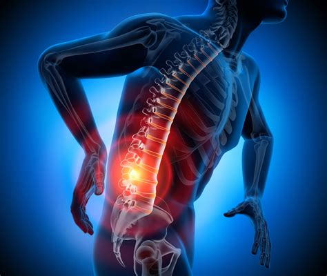 Image douleur-4 : Lombalgie : comment soulager les douleurs lombaires - Stress.app