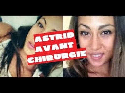 Auélie dotremont va subir une nouvelle opération de chirurgie esthétique et elle vient de révéler laquelle ! ASTRID NELSIA  LES ANGES  - AVANT CHIRURGIE - YouTube