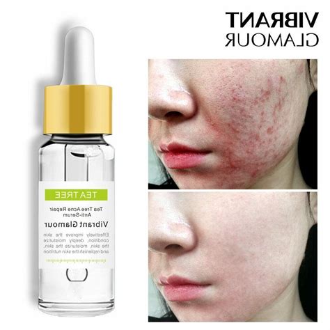 Apply this diy face serum recipe for acne, oily skin, scars and dark spots. Tea Tree Repair Face Serum Acne Scar Shrink