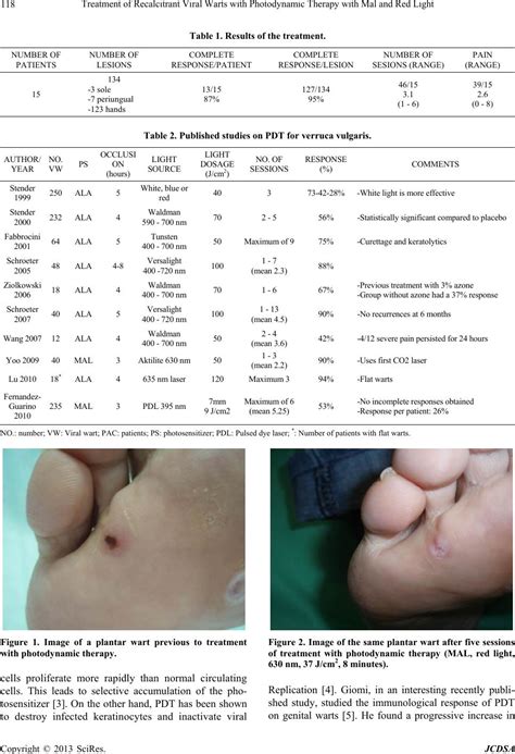 More expensive treatments for recalcitrant warts are offered in. Treatment of Recalcitrant Viral Warts with Photodynamic ...