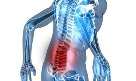 Kerengsaan perut kerap dari kolitis ulseratif boleh menyebabkan sakit belakang di bahagian pinggang sebelah kanan. (AMPUH) BEKAM UNTUK SAKIT PINGGANG SEBELAH KANAN, KIRI ...