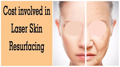 By undergoing skin resurfacing with a surgeon like dr. How Much Does Laser Skin Resurfacing Cost? | The Esthetic ...