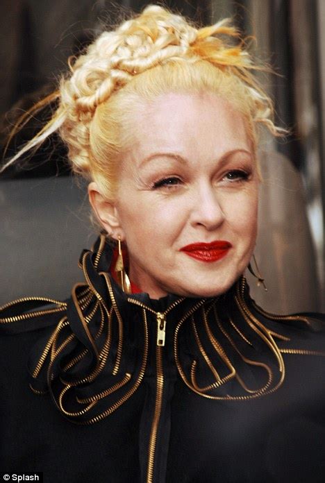 I capelli lunghi, il viso emaciato, i baffi folti: Star prima e dopo: Cindy Lauper irriconoscibile. Quali ...