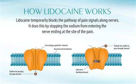 Or does it take a few hours or even days for the egg to attach? How long does it take for lidocaine to work, MISHKANET.COM