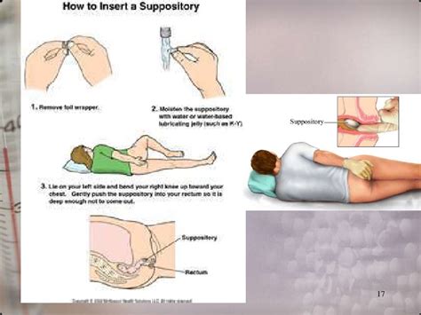 Take one dulcolax ® laxative suppository per day it generally produces a bowel movement within 15 to 60 minutes PHARMA-Drug forms