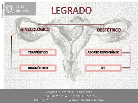 Legrado é um verbo, particípio de legrar outras informações sobre legrado: CLÍNICA MENCÍA TE INFORMA: LEGRADO UTERINO