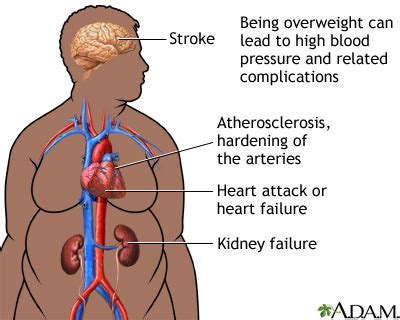 Overweight and obesity are associated with the risk for thyroid cancer. Obesity | Cardiac Health