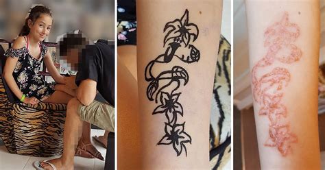 If you want to show off some body art over spring break, but you're not willing to have it permanently. Girl's 'temporary' black henna tattoo turns into oozing ...