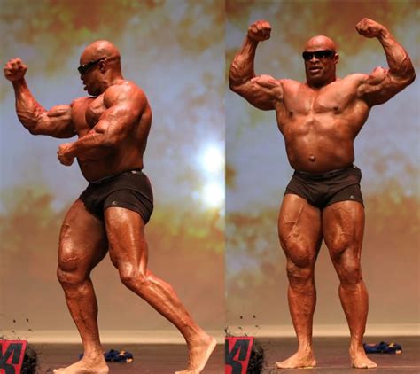 He won lots of titles and championships in his bodybuilding career. This is How Ronnie Coleman Looks After His Competing Days