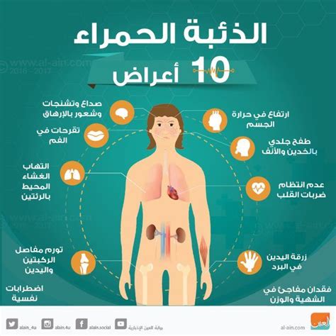 We did not find results for: المغرب هو الآخر معني بمرض الذئبة الحمراء | Abs, Lupus, Map