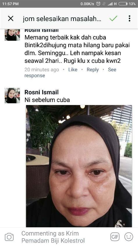 Konsumsi makanan dan minuman yang tinggi akan kandungan purin. Hilangkan Biji Kolesterol Sehebat Rawatan Lazer