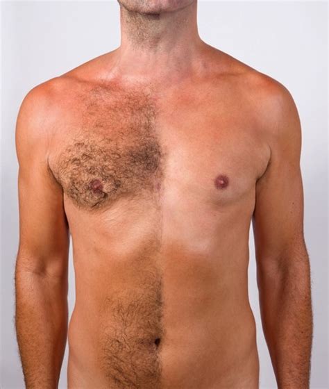 This is one of the oldest hair removal methods and tends to be great for sensitive skin. Best male waxing in Boston