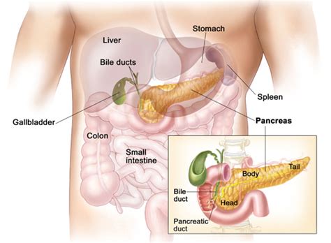 During a medical examination, your doctor may also detect other signs of pancreatic cancer, such as an enlarged gallbladder or the sudden onset of type 2 diabetes. Pancreas Cancer Symptoms | Australian Pancreatic Cancer ...