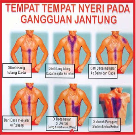 Beberapa Gangguan Penyebab Nyeri Dada Sebelah Kiri ...