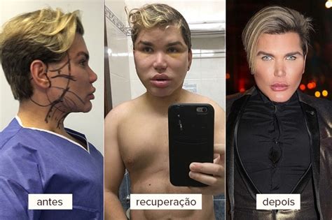 Veja o antes e depois da série jessie. EGO - Rodrigo Alves, o Ken Humano, refaz o rosto e admite ...