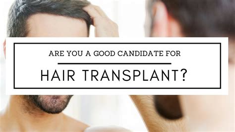 With over 30 years of experience, dr cotterill is an acknowledged leader in the hair restoration industry. Good candidates for HAIR TRANSPLANT | The Toronto Hair ...