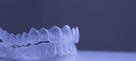 19 how long does it take for invisible. How Long Do Invisible Braces Take | Penn Dental Family ...