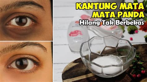 CARA MUDAH MENGATASI MATA PANDA SECARA ALAMI || MATA PANDA ...