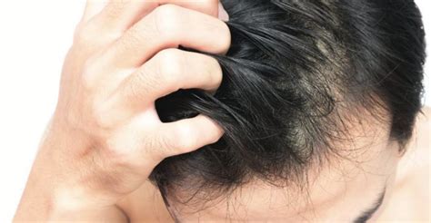 5 Common Hair And Scalp Problems You Should Be Aware Of ...