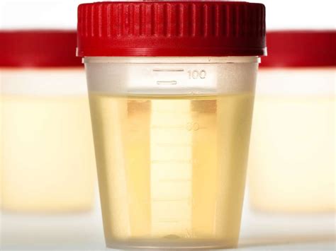 Blood And Protein In Urine What Does It Mean - ProteinWalls