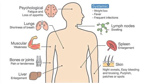 Leukaemia is the most common cancer in children. What Are Some of the Common Symptoms of Leukemia ...