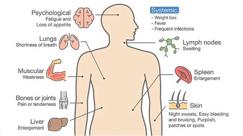 Symptoms of aml may include any of the following Leukaemia - Types, Causes, Symptoms, Diagnosis, Treatment